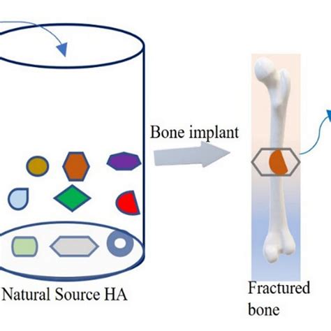 Nano-hydroxyapatite: Revolutionizing Bone Implants and Regenerative Medicine Applications!